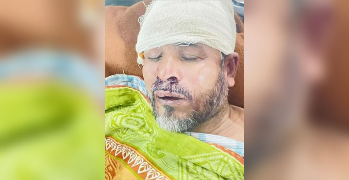 রূপগঞ্জে ১০ লাখ টাকা চাঁদা না দেওয়ায় ব্যবসায়ীকে গুলি, টেডা ইকবাল গ্রুপের হামলায় আহত বাদল