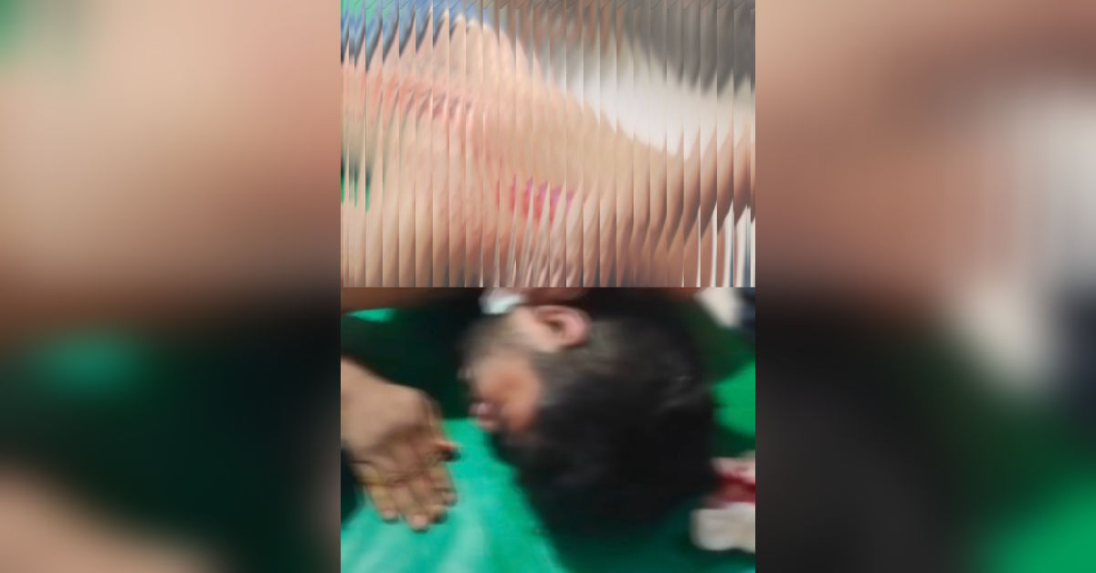 দিনে-দুপুরে কুপিয়ে হোসিয়ারি শ্রমিকের ৪০ হাজার টাকা ও আইফোন ছিনতাই—বন্দরে আতঙ্ক