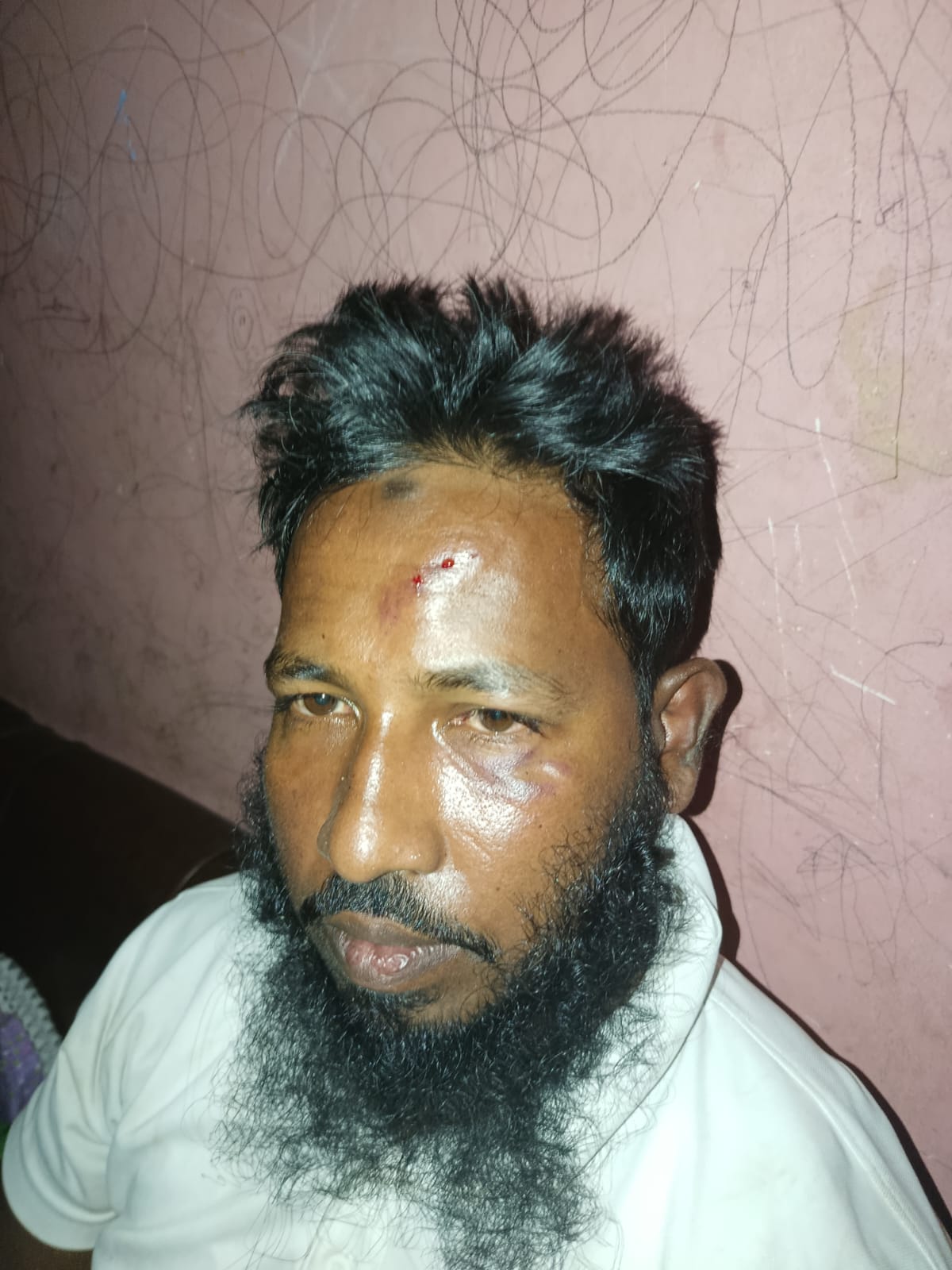 ফতুল্লায় কুতুবপুর ইউনিয়ন ৬নং ওয়ার্ড জামায়াত সেক্রেটারির ওপর সন্ত্রাসী হামলার অভিযোগ, থানায় মামলা